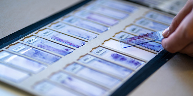 Order Entry für die Zytologie – digital in die Zukunft